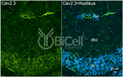 CACNA1E (Cav2.3) Antibody - FFPE Validated