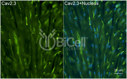 CACNA1E (Cav2.3) Antibody - FFPE Validated