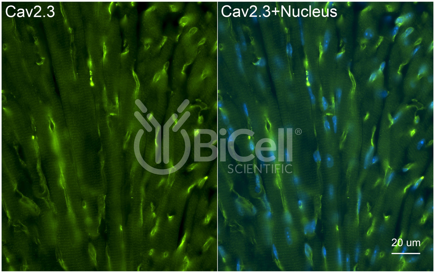 CACNA1E (Cav2.3) Antibody