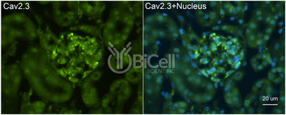 CACNA1E (Cav2.3) Antibody - FFPE Validated