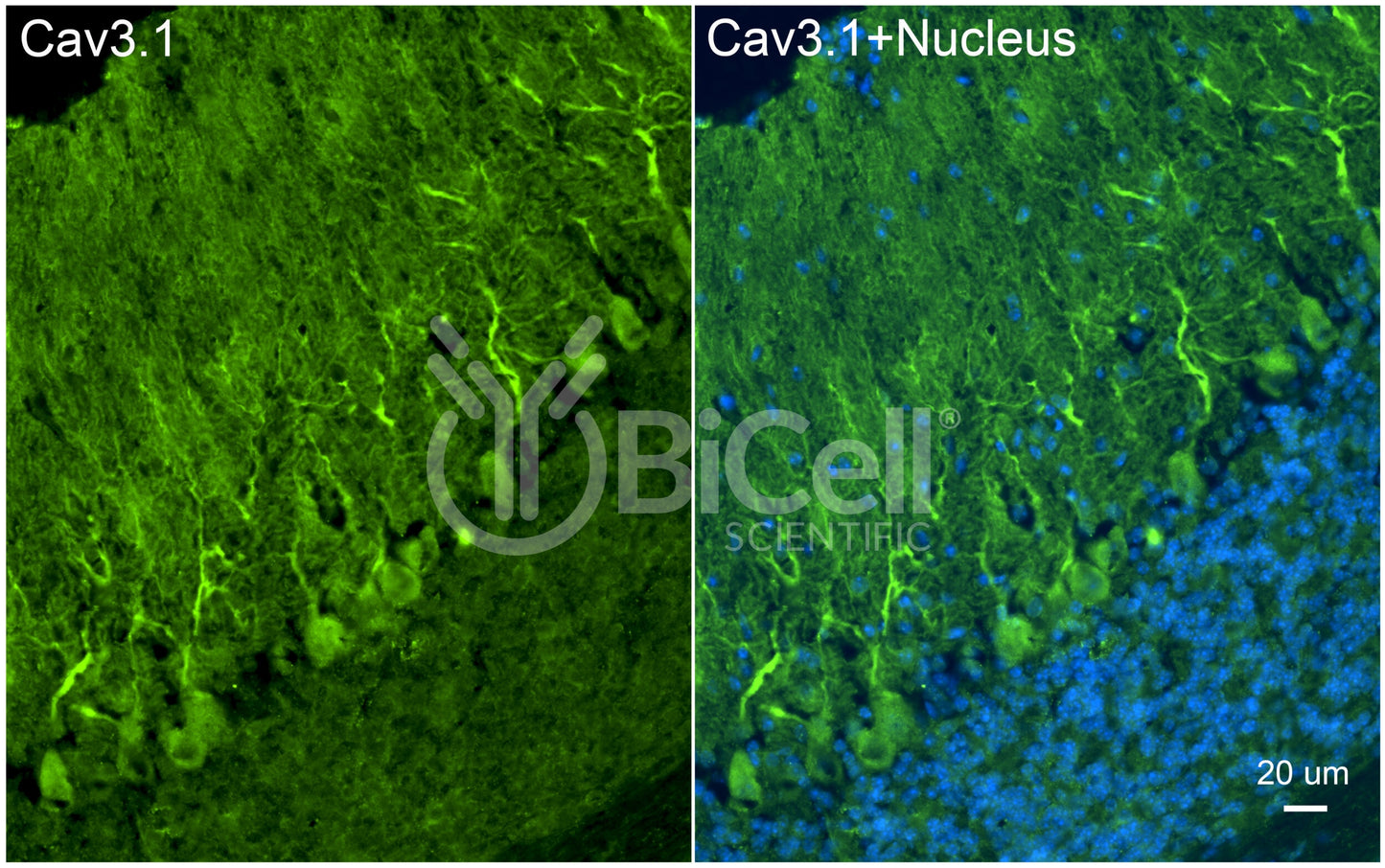 CACNA1G (Cav3.1) Antibody - Western Blot Validated