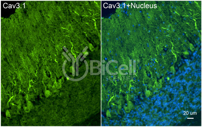 CACNA1G (Cav3.1) Antibody - FFPE Validated