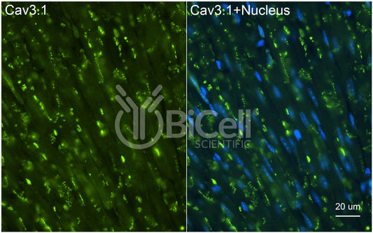 CACNA1G (Cav3.1) Antibody