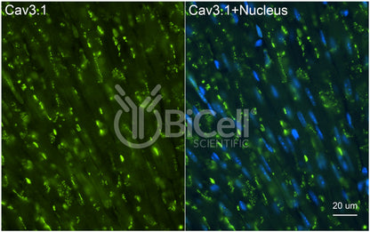 CACNA1G (Cav3.1) Antibody - FFPE Validated