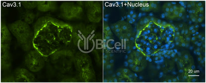 CACNA1G (Cav3.1) Antibody - Western Blot Validated