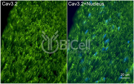 CACNA1H (Cav3.2) Antibody