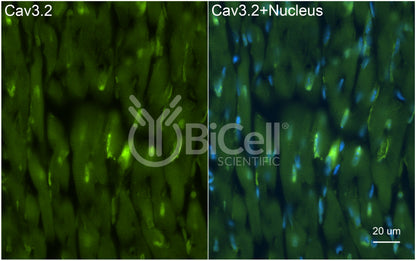 CACNA1H (Cav3.2) Antibody - Western Blot Validated