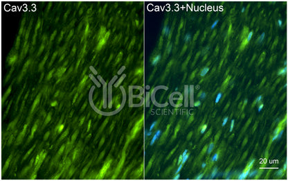 CACNA1I (Cav3.3) Antibody - Western Blot Validated