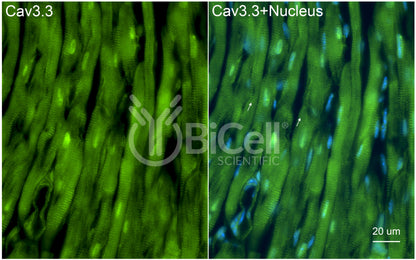 CACNA1I (Cav3.3) Antibody - Western Blot Validated