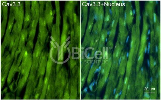 CACNA1I (Cav3.3) Antibody - Western Blot Validated
