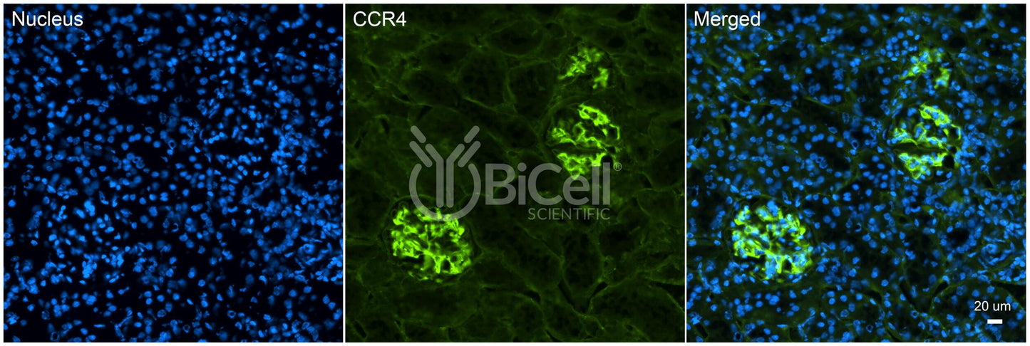 CCR4 (CD194) Antibody - Western Blot Validated