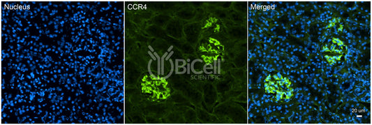 CCR4 (CD194) Antibody - Western Blot Validated