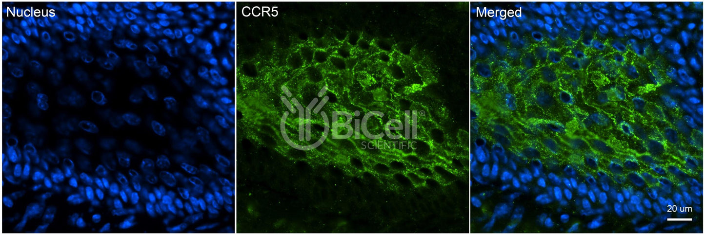 CCR5 (CD195) Antibody