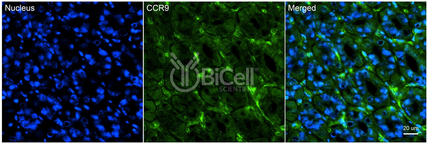CCR9 (CDw199) Antibody - Western Blot Validated
