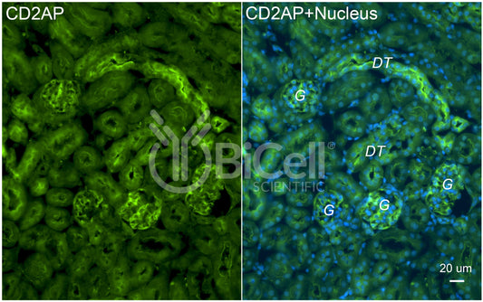 CD2AP Antibody - FFPE Validated