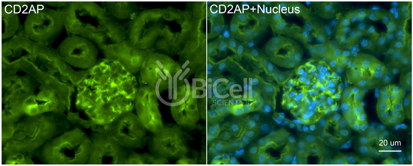 CD2AP Antibody