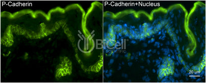 P-Cadherin (Cadherin-3 or CDH3) Antibody - Western Blot Validated