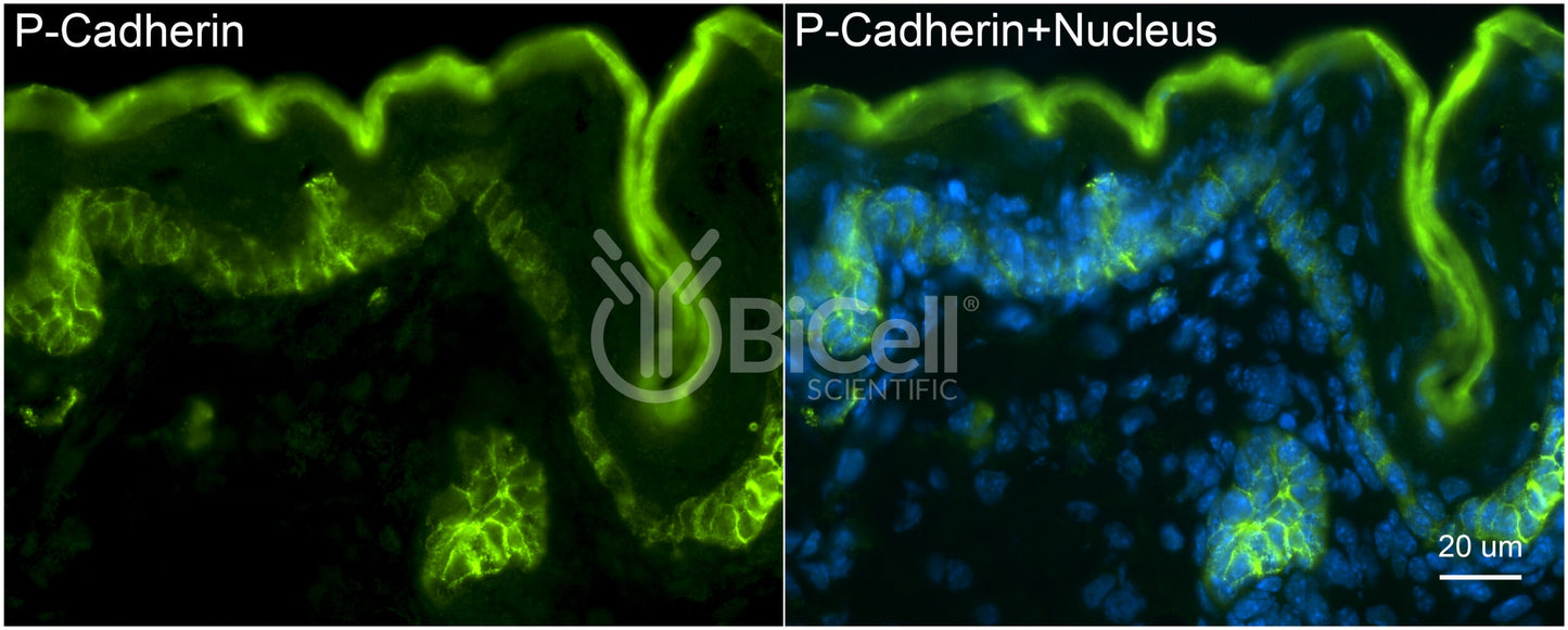 P-Cadherin (Cadherin-3 or CDH3) Antibody - FFPE Validated