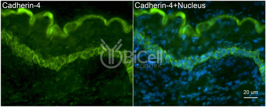 R-Cadherin (Cadherin-4 or CDH4) Antibody - FFPE Validated