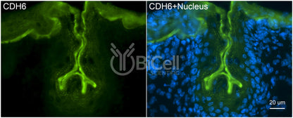 Cadherin-6 (CDH6) Antibody - FFPE Validated
