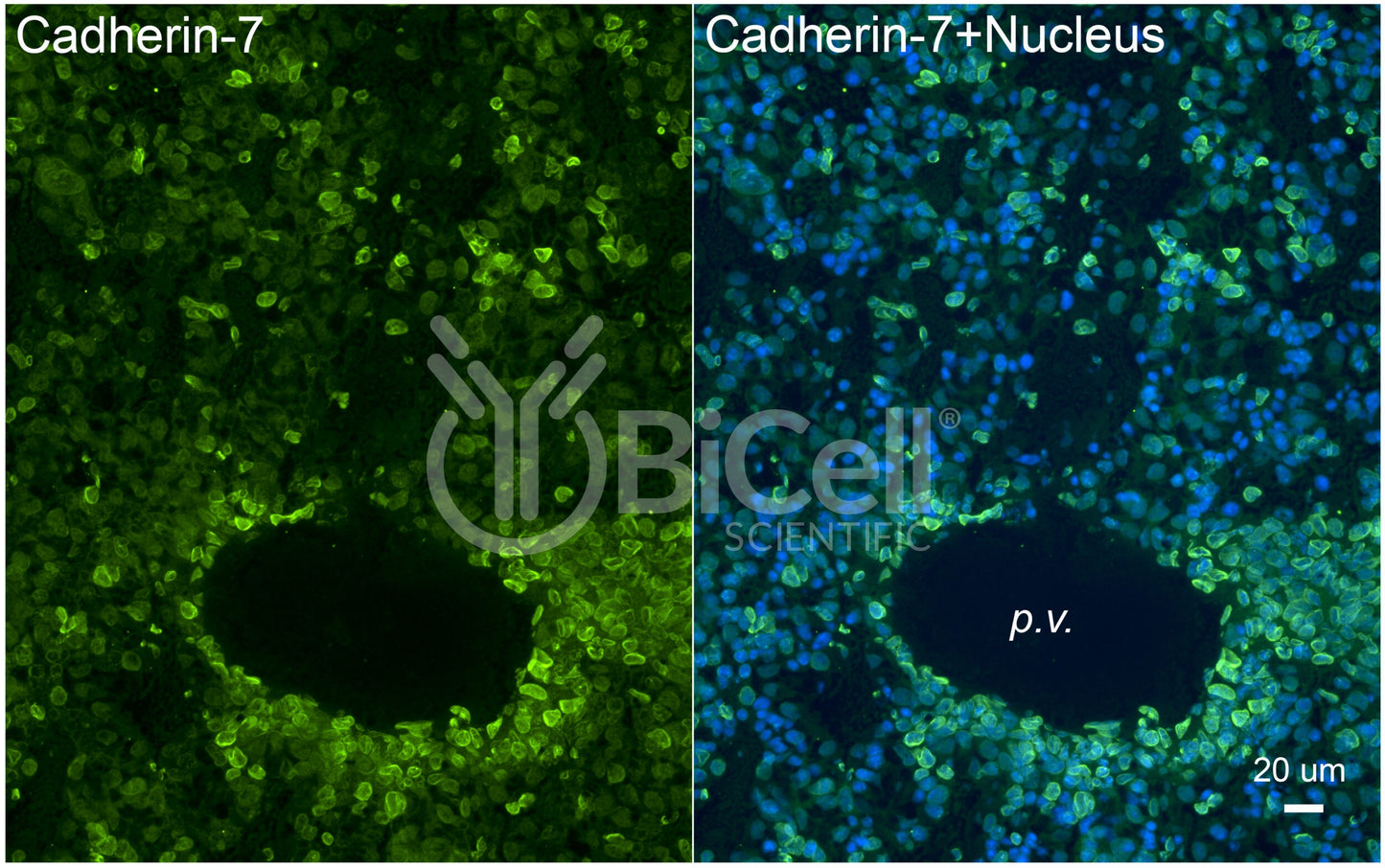 Cadherin-7 (CDH7) Antibody