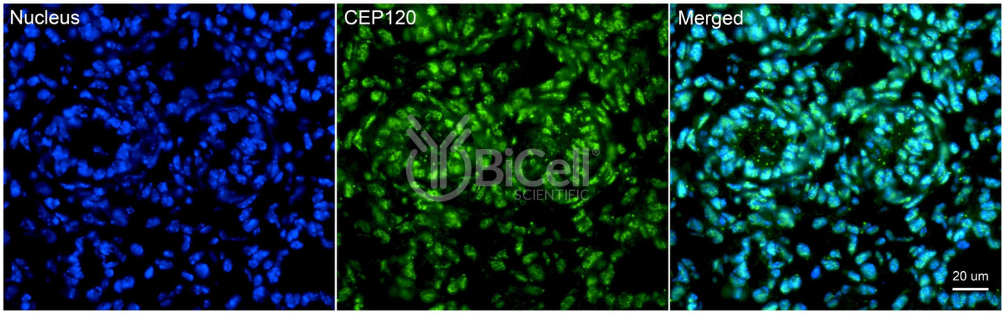 CEP120 (CCDC100) Antibody - Western Blot Validated