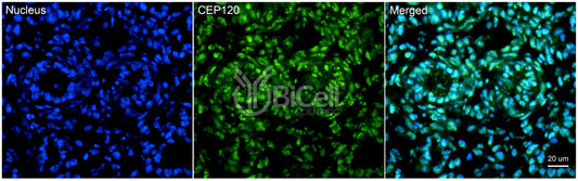 CEP120 (CCDC100) Antibody - FFPE Validated
