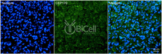 CEP170 (KIAA0470) Antibody - FFPE Validated