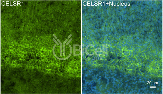 CELSR1 (CDHF9 or FMI2) Antibody - Western Blot Validated