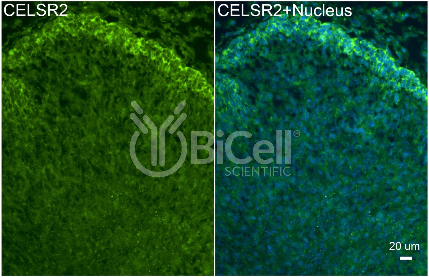 CELSR2 (CDHF10 or Flamingo1) Antibody