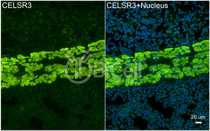 CELSR3 (CDHF11 or FMI1) Antibody - FFPE Validated