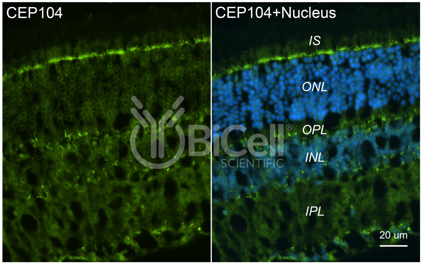 CEP104 Antibody - FFPE Validated