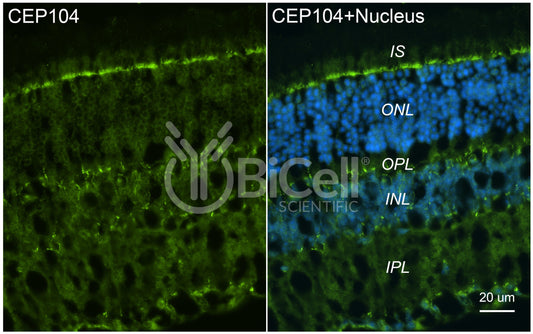 CEP104 Antibody - FFPE Validated
