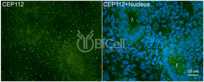 CEP112 (CCDC46) Antibody - FFPE Validated