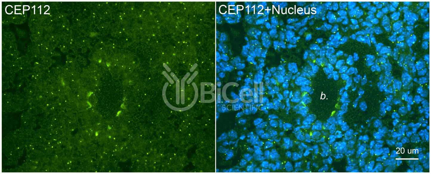 CEP112 (CCDC46) Antibody - Western Blot Validated