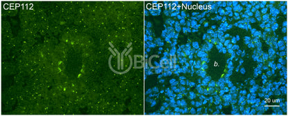 CEP112 (CCDC46) Antibody - FFPE Validated