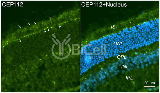 CEP112 (CCDC46) Antibody