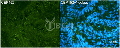 CEP152 Antibody