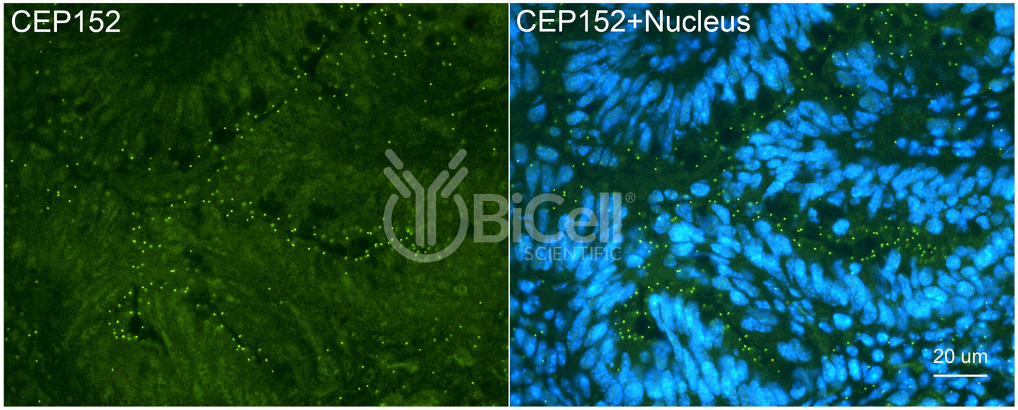 CEP152 Antibody - FFPE Validated