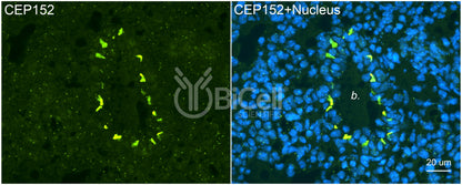 CEP152 Antibody - Western Blot Validated