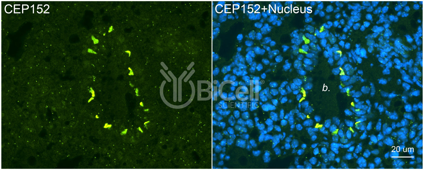 CEP152 Antibody - FFPE Validated