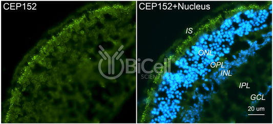 CEP152 Antibody - FFPE Validated