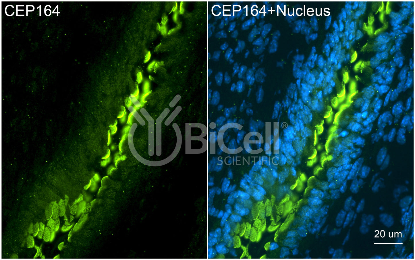 CEP164 (NPHP15) Antibody - FFPE Validated
