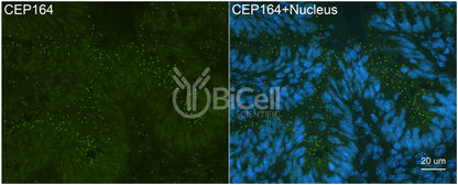 CEP164 (NPHP15) Antibody