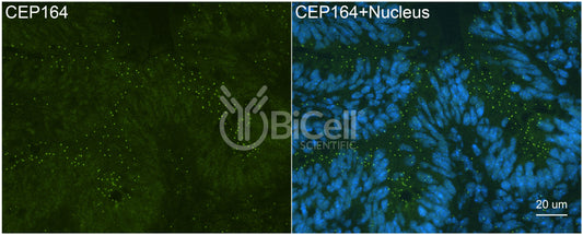 CEP164 (NPHP15) Antibody - FFPE Validated