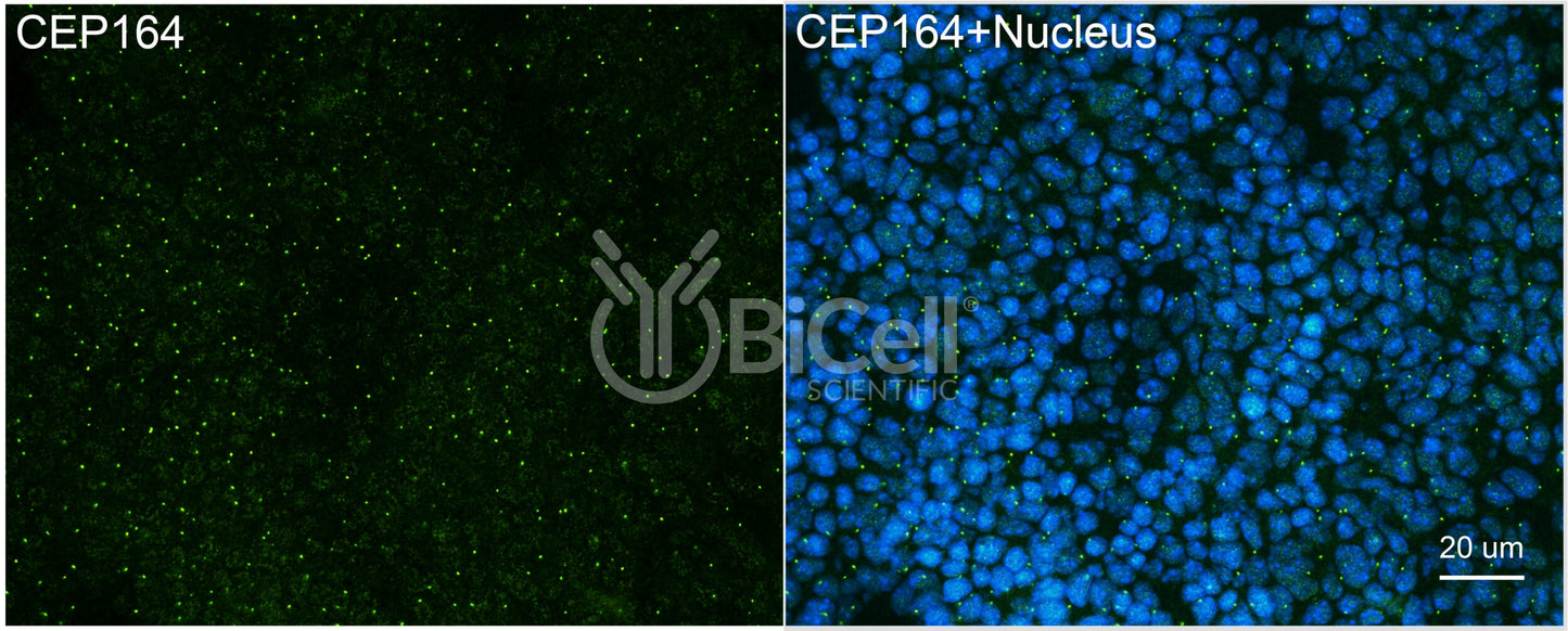 CEP164 (NPHP15) Antibody