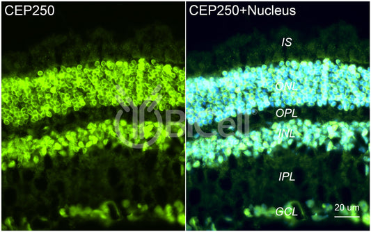 CEP250 Antibody - Western Blot Validated
