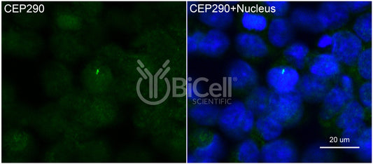 Nephrocystin-6 (Human) (NPHP6 or CEP290 or MKS4 or BBS14) Antibody - Western Blot Validated
