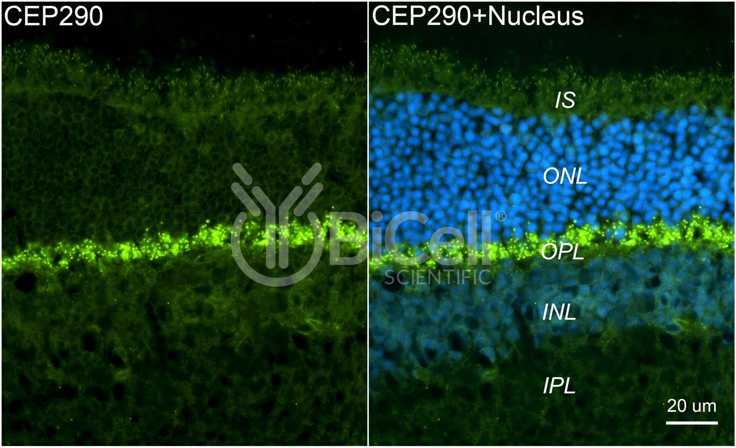Nephrocystin-6 (NPHP6 or CEP290 or MKS4 or BBS14) Antibody