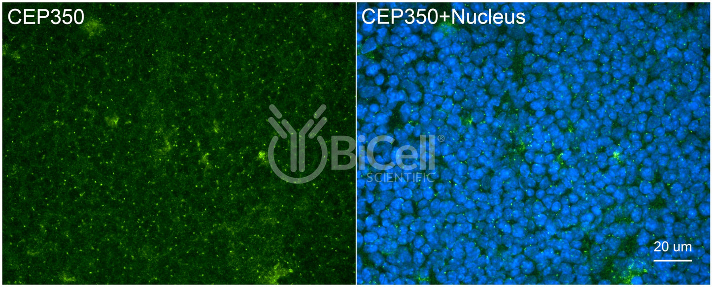 CEP350 Antibody - FFPE Validated